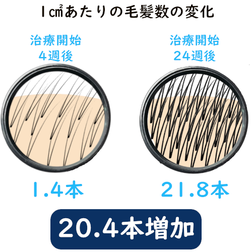 フォリックスFR15の発毛効果