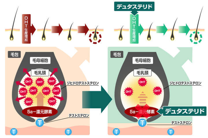 デュタスの作用機序